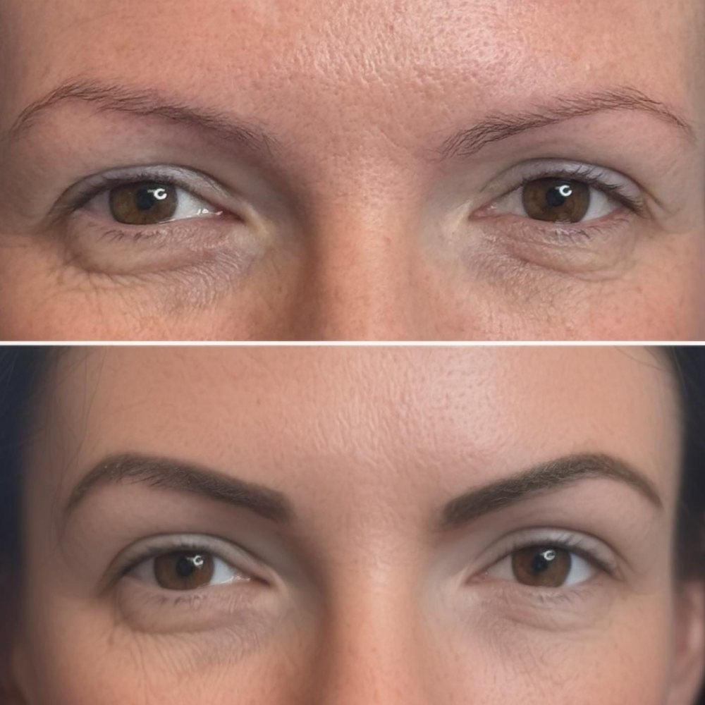 Colour correction before and after, faded patchy brow tattoo reworked into natural brows